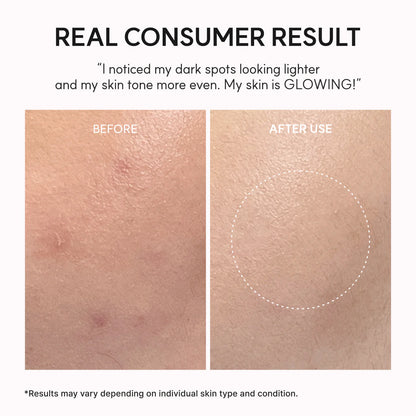 Arencia TXA Booster Shot – Dark Spot Correcting Serum
