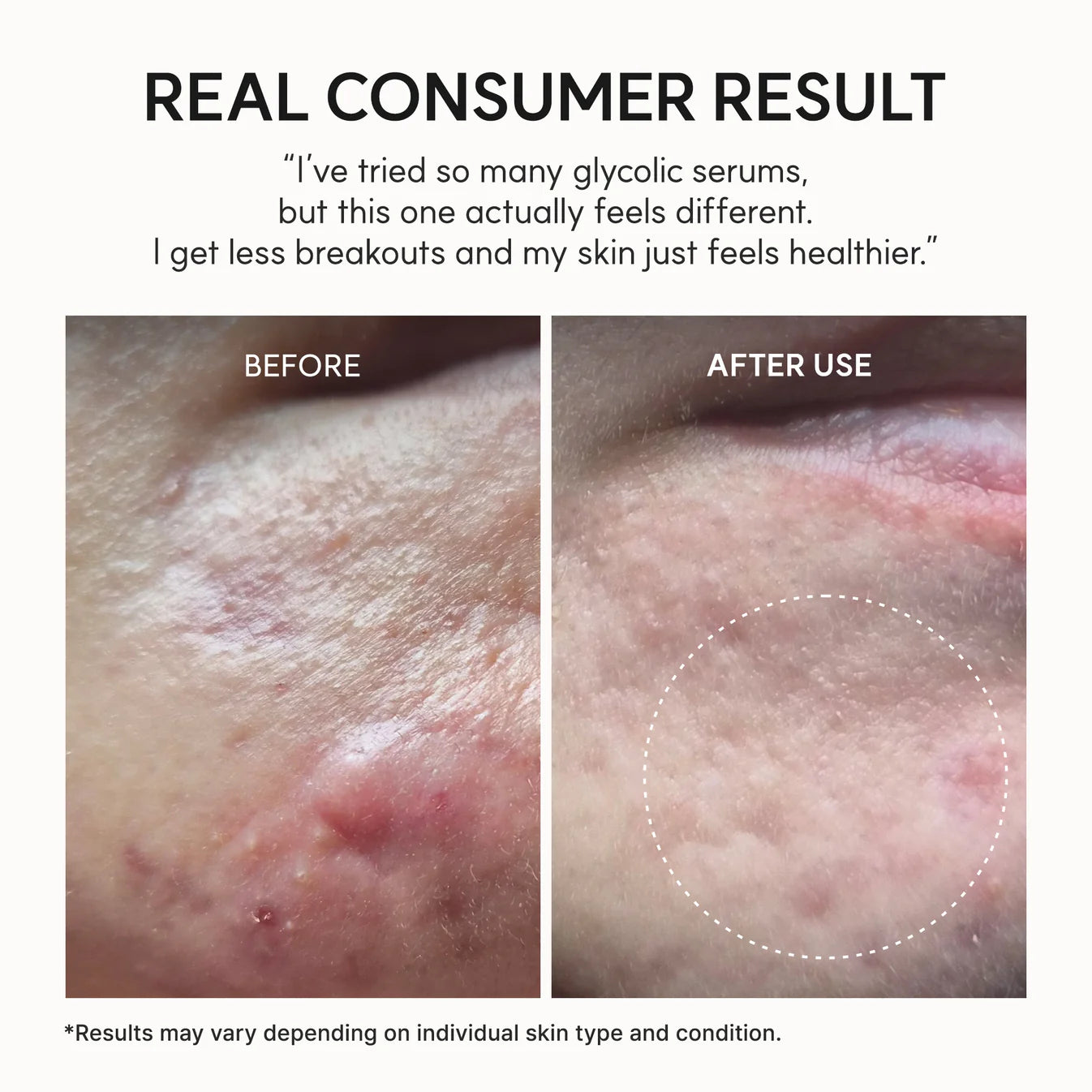 Arencia Eraser Shot Glycolic Acid Booster – Daily Exfoliating Serum