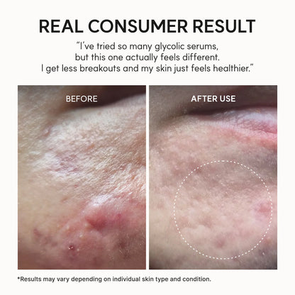 Arencia Eraser Shot Glycolic Acid Booster – Daily Exfoliating Serum