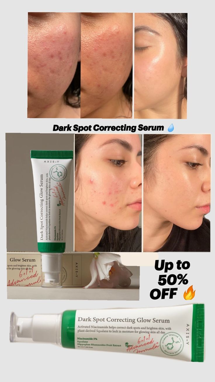 Dark Spot Correcting Glow Serum – Advanced Brightening & Skin Repair Treatment