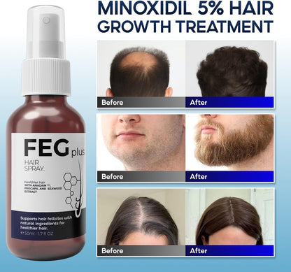 FEG PLUS Minoxidil Hair & Beard Growth Serum