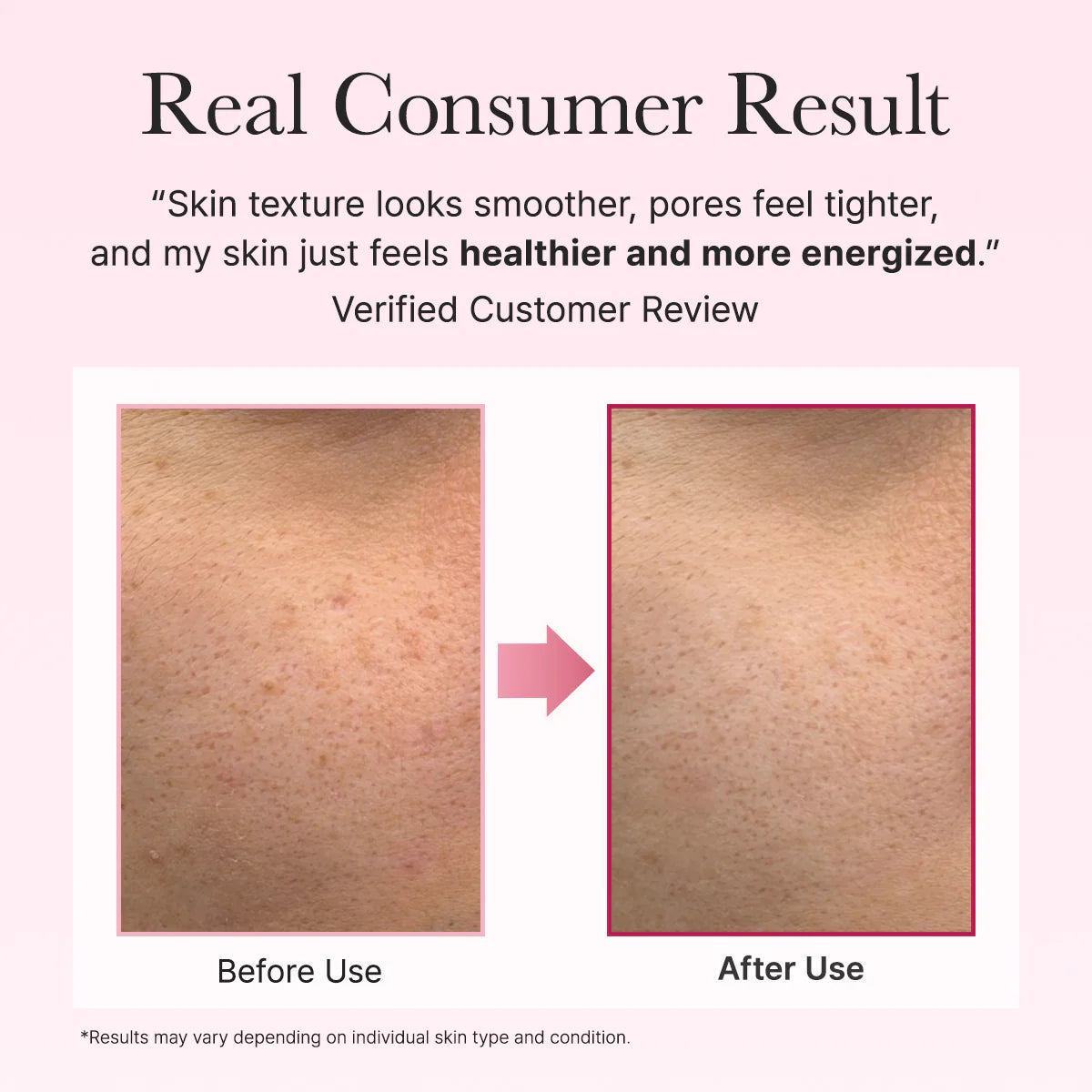 Arencia PDRN Booster Shot – Renewing & Plumping Serum