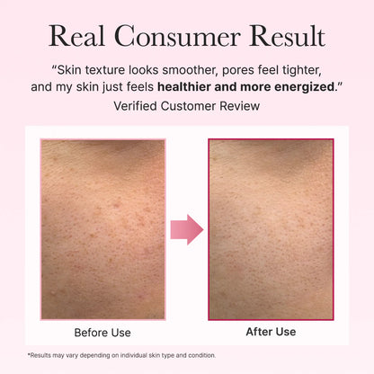 Arencia PDRN Booster Shot – Renewing & Plumping Serum