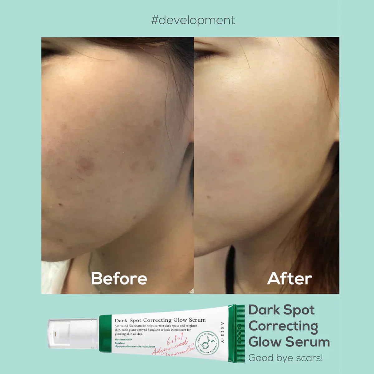 Dark Spot Correcting Glow Serum – Advanced Brightening & Skin Repair Treatment