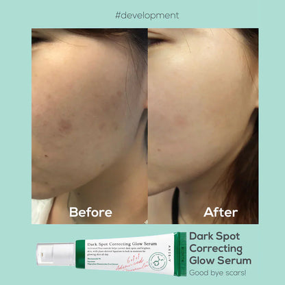 Dark Spot Correcting Glow Serum – Advanced Brightening & Skin Repair Treatment