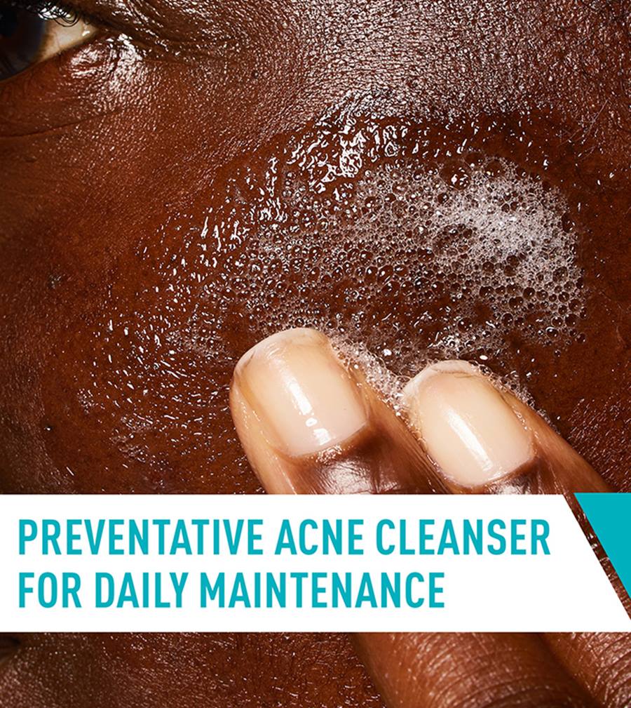 CeraVe Acne Control Cleanser 2% Salicylic Acid – Oil Control Face Wash for Acne & Blackheads