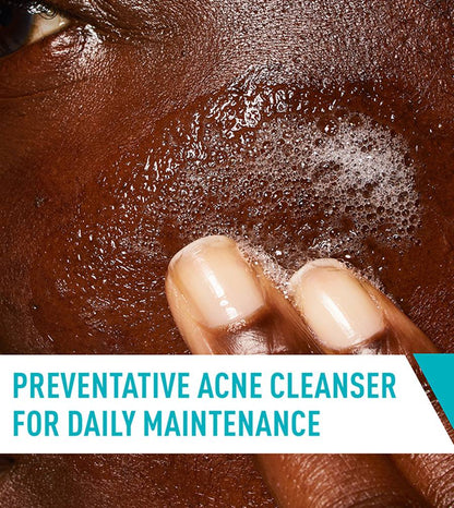 CeraVe Acne Control Cleanser 2% Salicylic Acid – Oil Control Face Wash for Acne & Blackheads