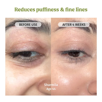 Dark Spot Correcting Glow Serum – Advanced Brightening & Skin Repair Treatment